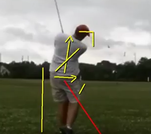 Club Alignments and Regaining Flexion